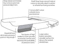 M2 Anti-Thrust Wheelchair Cushion by Comfort Company